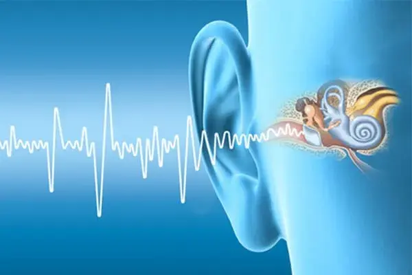 perda-auditiva-neurossensorial-1.webp